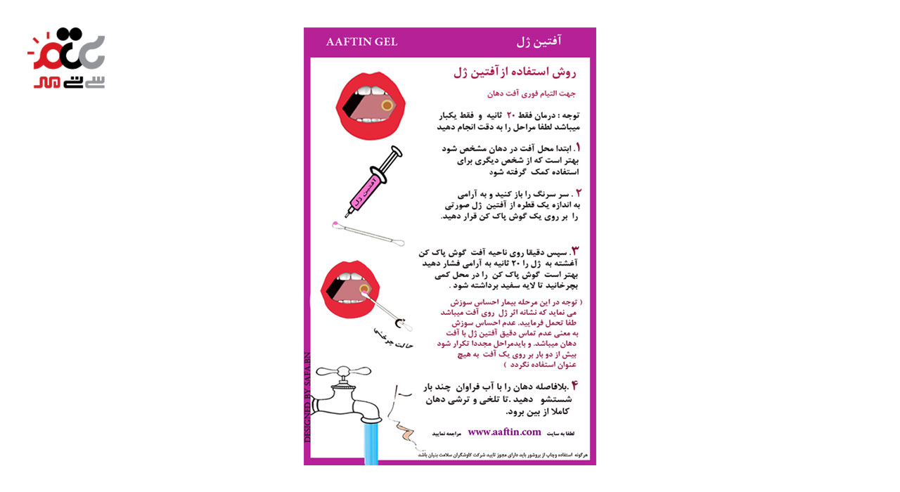 خرید ژل موضعی آفتین ژل جهت درمان قطعی آفت دهان  14 گرمی
